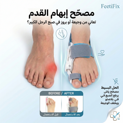 مصحّح إبهام القدم